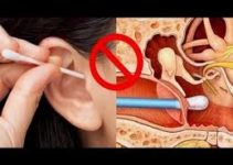 O uso de cotonete  deve ser evitado para limpar os ouvidos