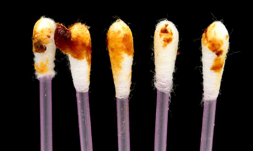 A Verdade Sobre limpeza e lavagem dos seus ouvidos/orelhas!