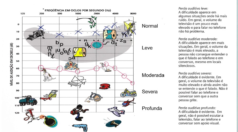 audiograma com perda auditiva